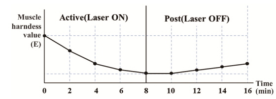Schematic diagram showing the muscle tension level as a function of time during laser treatment.