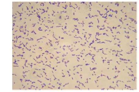 The gram staining of NH-3 isolate.