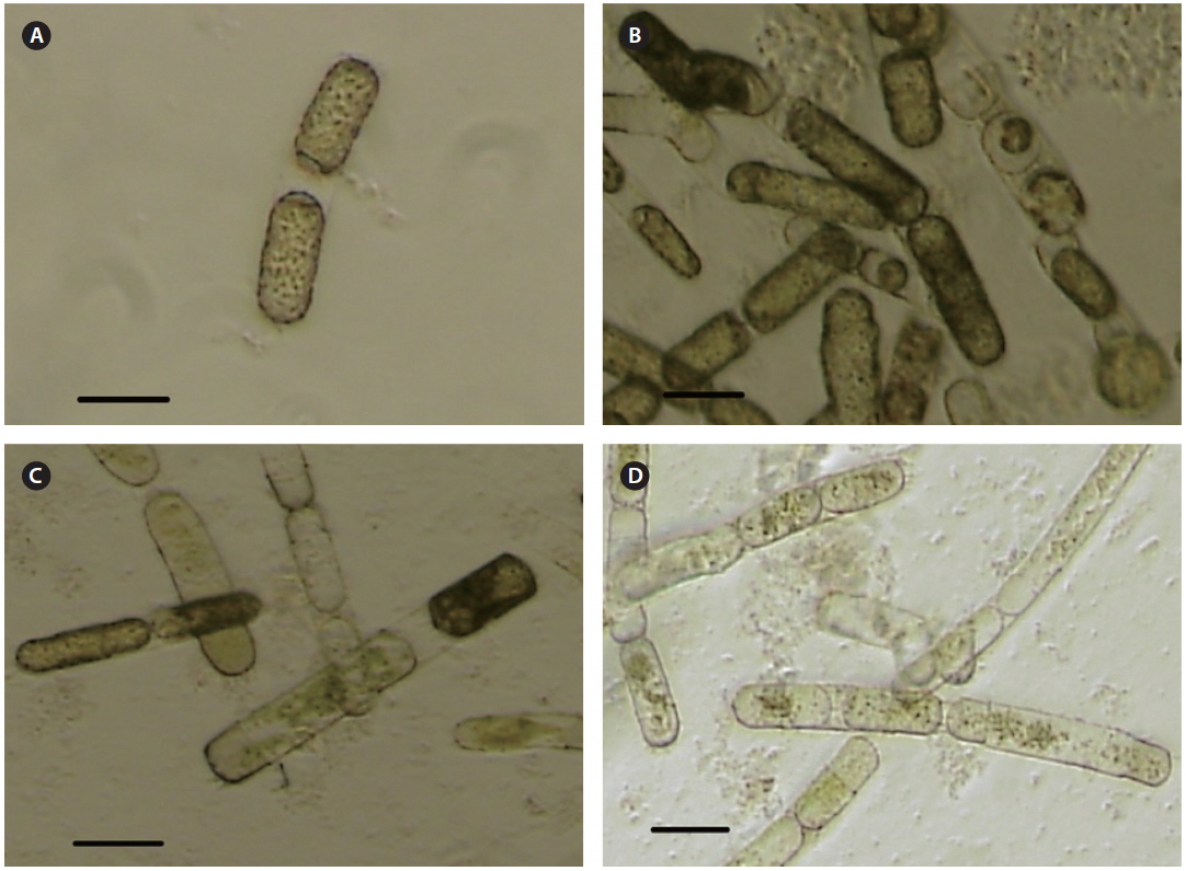 Images of healthy culture and Stephanopyxis palmeriana virus (SpalV)-inoculated culture. Light micrographs of a S. palmeriana culture at 0 day (A), 1 day (B), 2 days (C), and 4 days (D) post-inoculation with SpalV. Scale bars represent: A-D, 100 μm.
