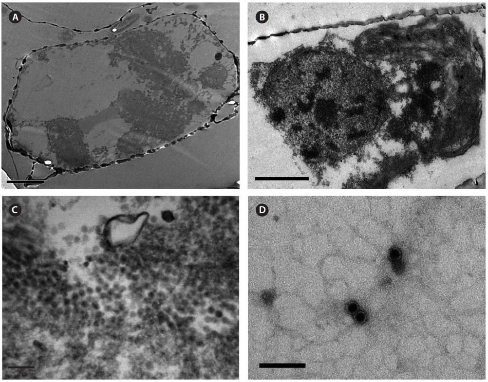Electron micrographs of Stephanopyxis palmeriana virus (SpalV). (A) Healthy cell, S. palmeriana NF-D-SPA-1. (B & C) Cells infected by the pathogen SpalV. (B) Post inoculation (48 h); numerous small dense masses that appears to be fragmenting. (C) Higher magnification image of the virus-like particles in the host cytoplasm. (D) Negatively stained virus-like particles from lysate. Scale bars represent: A & B, 1 μm; C & D, 100 nm.