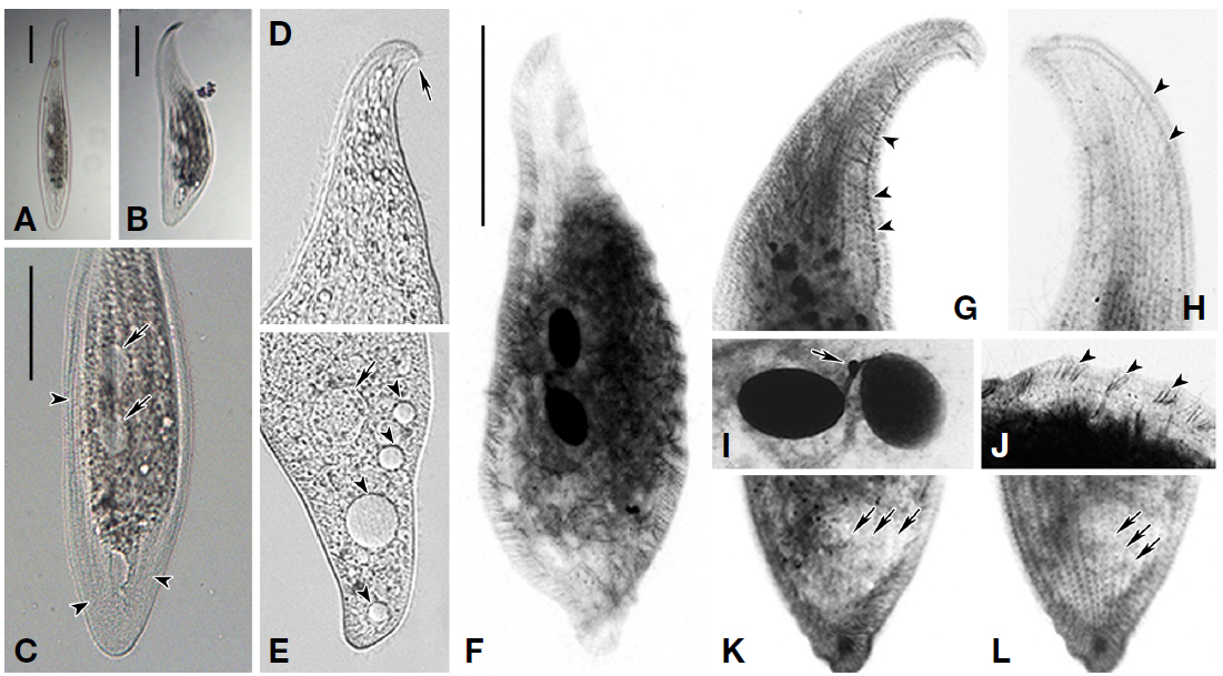 Photographs of Loxophyllum perihoplophorum from live (A-E) and protargol stained (F-L) specimens. A, B, View of live specimen; C, Macronuclear nodules (arrows) and thin and wide extrusome-belted zone (arrowheads); D, Beak-like anterior region (arrow); E, Posterior region, contractile vacuoles (arrowheads) and food vacuole (arrow); F, Appearance of protargol stained specimen; G, Dorsal brush kinety (arrowheads); H, Right view of anterior region, perioral kineties (arrowheads); I, Nuclear apparatus, micronucleus (arrow); J, Warts (arrowheads); K, L, Posterior region, left somatic kineties (arrows in K) and right somatic kineties (arrows in L). Scale bars=100 μm.