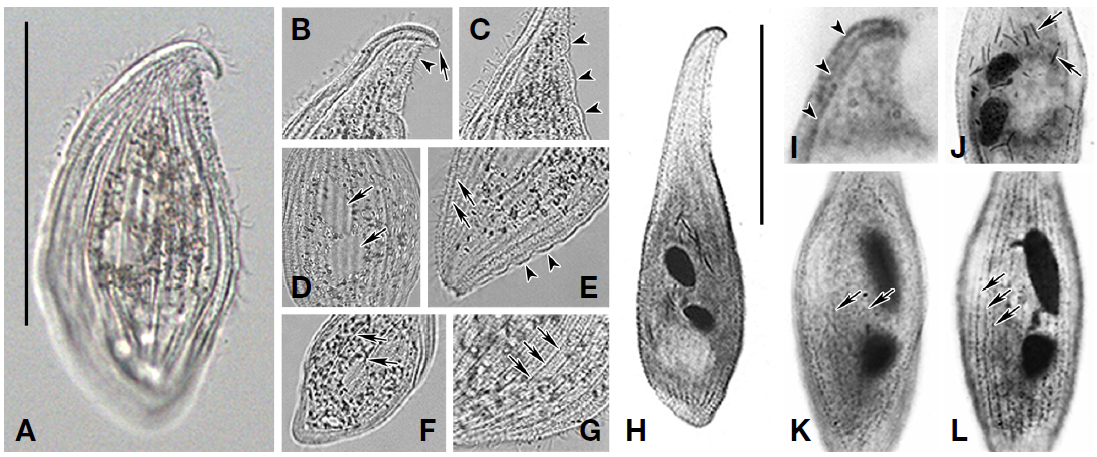 Photographs of Loxophyllum rostratum from live (A-G) and protargol stained (H-L) specimens. A, Left view of live specimen; B, Beak-like anterior region (arrow) and winding neck-dorsal portion (arrowhead); C, Warts (arrowheads) in anterior region; D, Macronuclear nodules (arrows); E, Extrusomes (arrows) and warts (arrowheads); F, Furrows (arrows); G, Somatic kineties (arrows); H, Appearance of protargol stained specimen; I, Anterior region, perioral kineties (arrowheads); J, Extrusomes in body (arrows); K, L, Middle region, left somatic kineties (arrows in K) and right somatic kineties (arrows in L). Scale bars=80 μm.