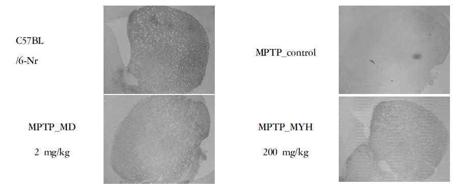 Effects of Modified Yuldahanso-tang (MYH) on the Immunohistochemistry of TH-immunoresponsive (TH-IR) neurons in the Striatum (ST) in the MPTP-induced Parkinson's disease mice
