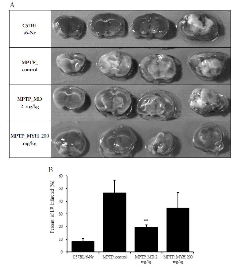 Effects of Modified Yuldahanso-tang (MYH) on the coronal section in the MPTP-induced Parkinson's disease mice