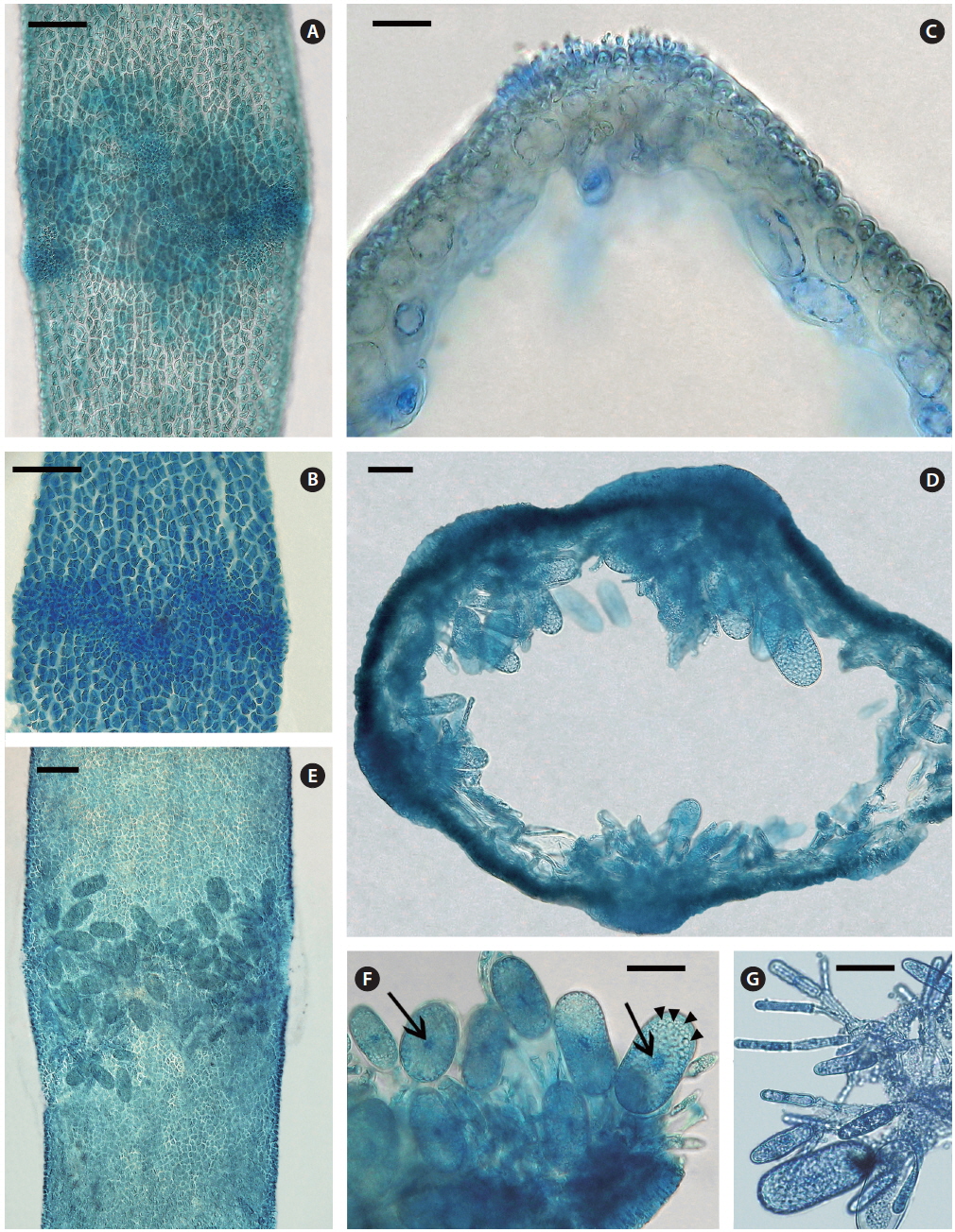 Lemanea manipurensis E. K. Ganesan, J. A. West, Zuccarello et J. Rout sp. nov. All specimens lightly stained with aniline blue. (A) Small spermatangial patches around an old branch perimeter. (B) Spermatangial patches extend almost continuously around a young branch perimeter. (C) Branch cross section with small spermatangial patch erumpent on outer cortex. (D) Cross section with carposporophytes projecting into the hollow branch center. (E) Surface view of several carposporophytes in a whorl projecting inwardly. (F) Single carpospores terminal on carposporophyte branches. Numerous small colourless spherical bodies (arrowheads) and central nucleus (arrows) visible in each carpospore. (G) Individual carposporophyte removed from thallus to show repeated branching and terminal carpospores. Scale bars represent: A, 65 μm; B, 25 μm; C, 100 μm; D-G, 40 μm.