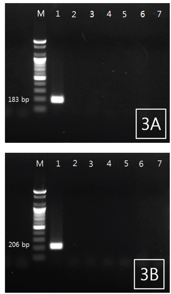 PCR results obtained using (A) RN-18S1 primer and (B) RN-18S2 primer sets, with lanes M to 7 as follows: 100 bp DNA ladder, Nematode with rockfish Sebastes schlegeli, Scutica with flounder Paralichthys olivaceus, Kudoa with flounder, Anisakis with rockfish, Anisakis with flounder, Edwardsiella tarda and Streptococcus iniae.
