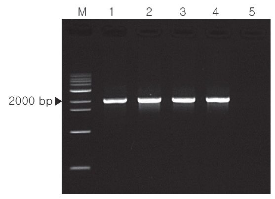 Detection of Edwardsiella ictaluri from yellow catfish Pelteobagrus fulvidraco using the E. ictaluri-specific primer sets IVS and IRS. M=molecular marker. 1: Present isolate (YCK-1). 2: present isolate (YCL-1). 3: B-4 (E. ictaluri from Korean catfish). 4: ATCC 33202 E. ictaluri). 5: GEONGGI-01 E. tarda from Korean catfish).