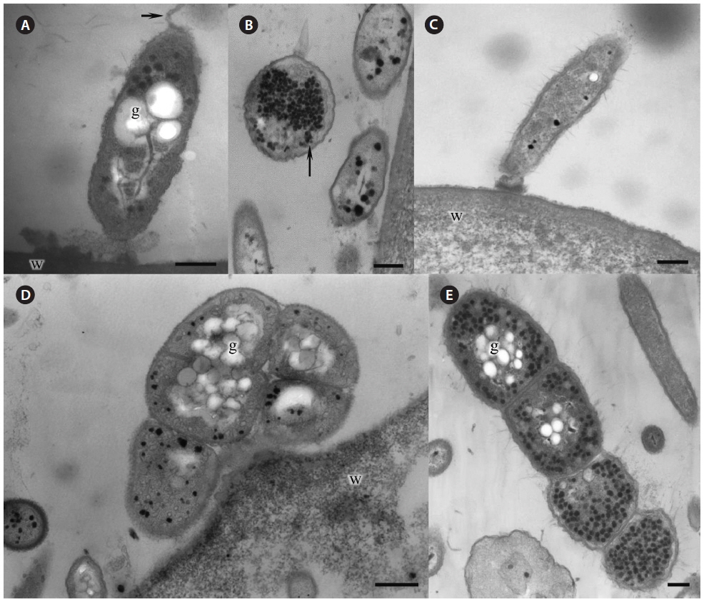 Electron micrographs of green-spot disease and cyanobacteria felt-producing organisms isolated from Pyropia sea farms in Seocheon and Jindo. (A) Pseudoalteromonas sp. flagellum (arrow) and abundant reserve granules can be seen. (B) Many bacteria were packed with numerous black polyhedral inclusion bodies (arrow). (C) Vibrio sp. (D & E) Coccoid (D) and filamentous (E) cyanobacteria attached to the surface of Pyropia are the causative agents of cyanobacteria felt. g, reserve granules; w, cell wall matrix of Pyropia. Scale bars represent: A-C & E, 200 nm; D, 500 nm.