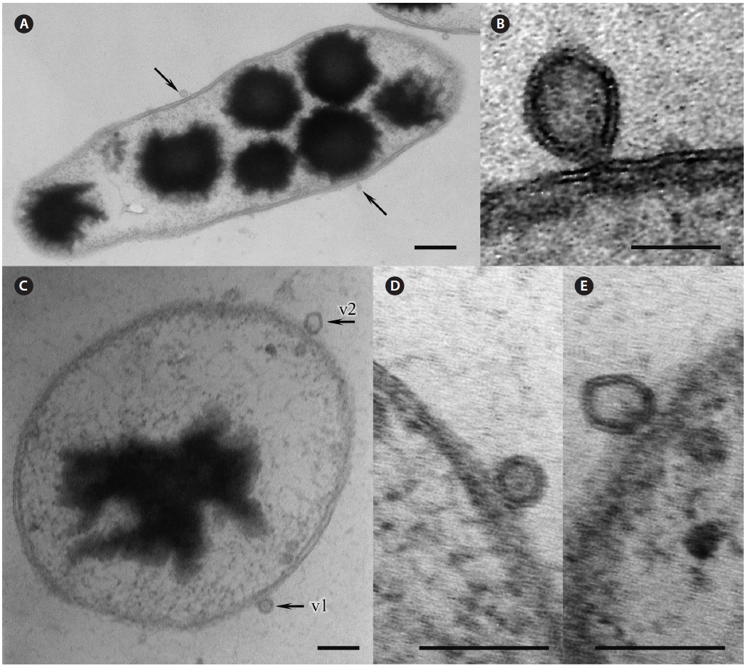 Electron micrographs of bacteria with membrane vesicles that were present in the debris from lysed Pyropia that showed signs of greenspot disease and cyanobacteria felt. (A & C) Longitudinal (A) and transverse (C) sections of bacteria with large black inclusions and membrane vesicles (arrows). (B, D & E) Enlarged images of the membrane vesicles (D & E, marked as v1 and v2 on Fig. 4C, respectively). v1, v2, membrane vesicles. Scale bars represent: A, 200 nm; B-E, 100 nm.
