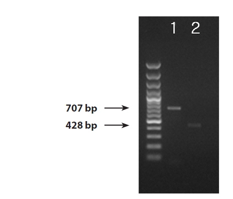 Amplification of the nuclear ribosomal DNA internal transcribed spacer (ITS) region and mitochondrial DNA of the cox1 region using Pythium porphyrae specific ITS primers (1) (Park et al. 2001) and cox1 primers (2). Total genomic DNA was extracted from a culture strain (Shinan, Korea) and used as template DNA for polymerase chain reaction.
