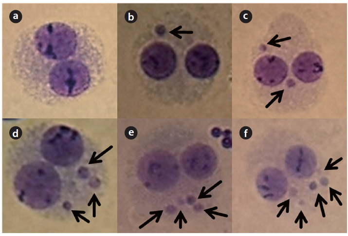 Representative image of cells irradiated with 5 Gy γ-rays at ×400 magnification: (a) normal binucleated cell, binucleated cell with (b) 1 micronucleus, (c) 2, (d) 3, (e) 4, (f ) 5 micronuclei. The arrows indicate the micronucleus in a binucleated cell.
