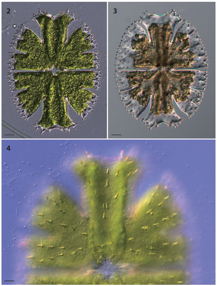 Figs. 2-4. Micrasterias apiculata. Scale bars represent 20 μm (Figs. 2, 3) and 10 μm (Fig. 4).
