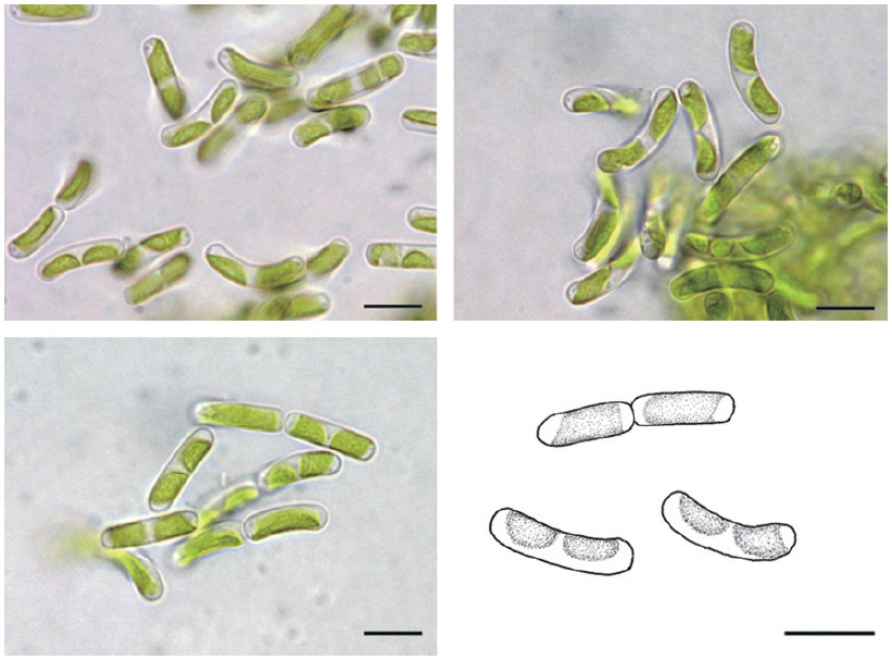 Microscopic photographs and illustrations of Nephrodiella lunaria Pascher found in Hongcheon-river of Gangwon-do from December 2011 to June 2012. Scale bars, 10 μm.
