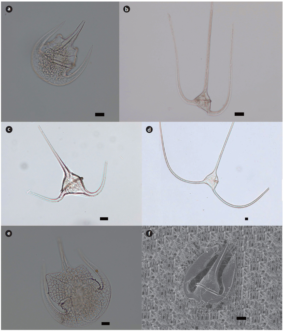 Light micrographs and scanning electron micrograph (SEM) of the genus Tripos. (a) T. limulus (VV), (b) T. longissimus (DV), (c) T. macroceros var. gallicus (DV), (d) T. massiliensis var. massiliensis (DV), (e) T. paradoxides (VV), (f ) T. lamellicornis (SEM, DV). Scale bars, 20 μm; DV, dorsal view; VV, ventral view.