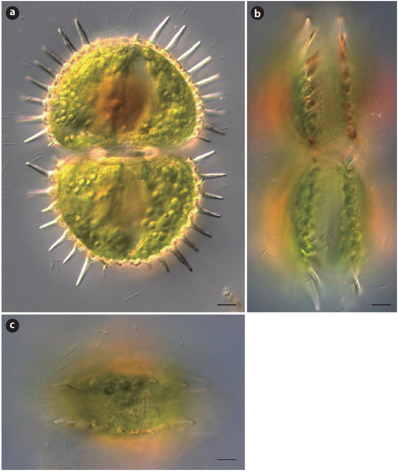 Xanthidium superbum, (a) front view, (b) lateral view, and (c) vertical view. Scale bars, 10 μm.