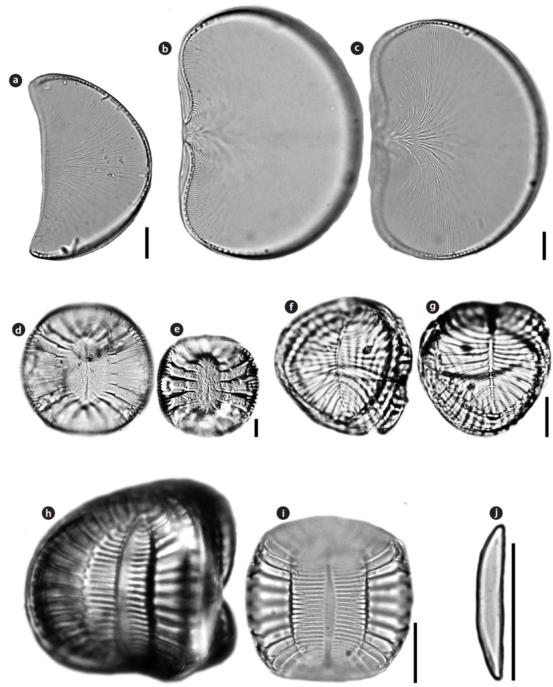 Light microscopy (LM) microphotographs. (a) Auricula complexa, (b, c) Auricula flabelliformis, (d, e) Campylodiscus ambiguus, (f, g) Campylodiscus decorus, (h, i) Campylodiscus samoensis, and (j) Catenula adhaerens. Scale bars, 10 μm.