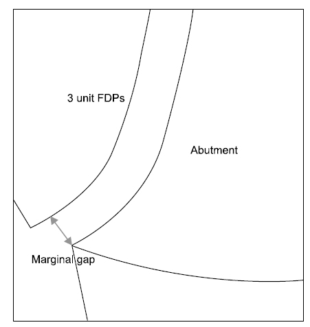 Marginal gap of abutment. FDPs: fixed dental prostheses.