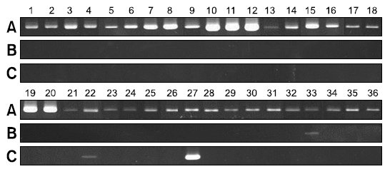 Universal primers (A) were used to confirm the presence of bacteria in samples genomic DNA extracted. Detection of Pseudomonas species (spp.) (B) and non-tuberculous Mycobacterium spp. (C) with specific primers. Polymerase chain reaction products were electrophoresed on 1.5% agarose gel and stained with ethidium bromide.