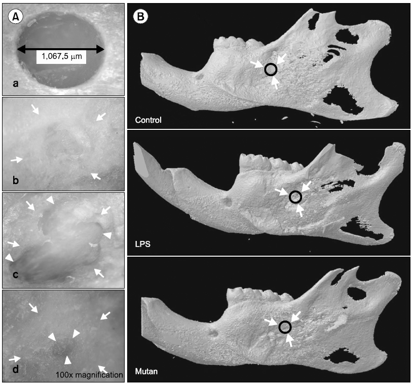 Effect of mutan on bone healing in Sprague-Dawley rats. (A) Photomicrographs of mandibles from rats treated with mutan for 4 weeks after healing. Arrowheads point to the original defect margins, and the arrows show bone healing margin. a: after 1 day defect formation, b: saline administration after defect formation, c: lipopolysaccharide (LPS) (1 mg/kg of body weight) administration after defect formation, d: mutan (1 mg/kg of body weight) administration after defect formation. (B) Micro-computed tomography images of rats after healing on alveolar bone defect (arrows and black circles: bone defect and healing area). Bone was visualized using an upright microscope (CKX41; Olympus Corporation, Tokyo, Japan).