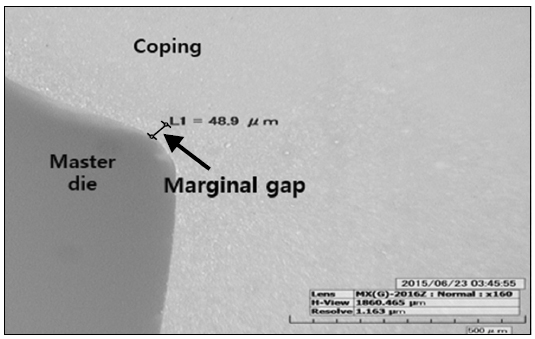 Measurement of marginal and internal gap (digital microscope, ×160).
