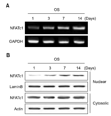 Time course of NFATc1 messenger RNA and protein expression on osteogenic medium (OS)-induced differentiation of human periodontal ligament cells. (A) Total RNA was isolated and analyzed by reverse transcription-polymerase chain reaction. (B) NFATc1 protein levels were analyzed by western blotting. The data presented are representative of three independent experiments. GAPDH: glyceraldehyde-3-phosphate dehydrogenase.
