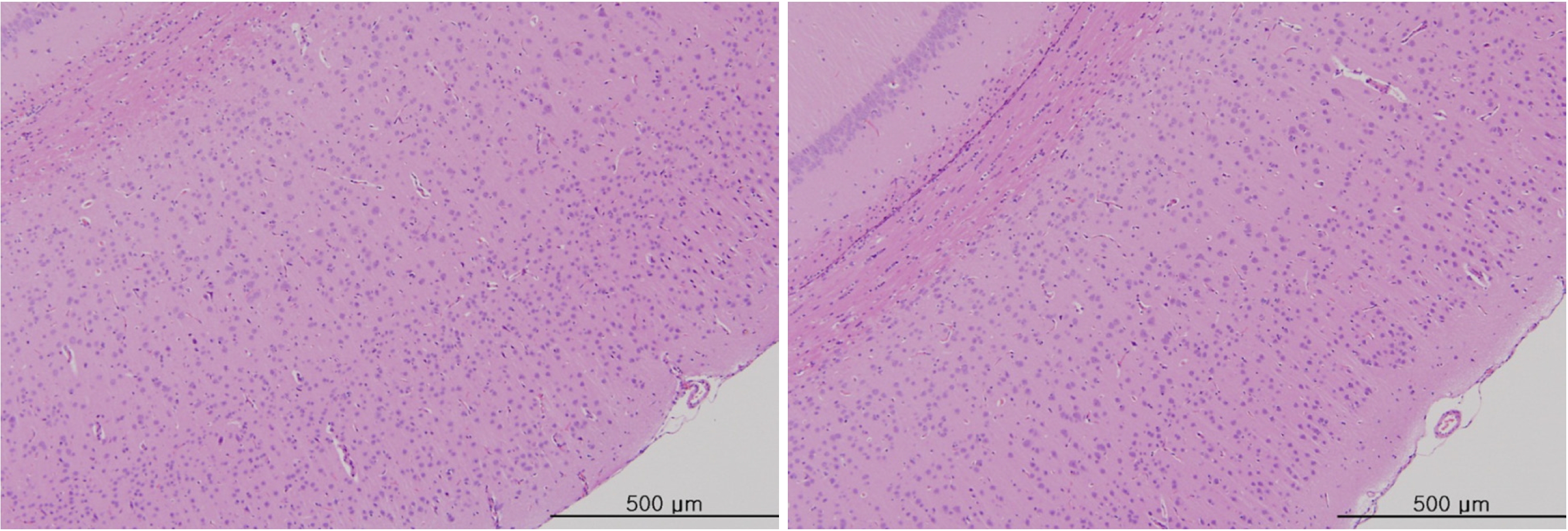 Tissue from the brain in the intravenous single-dose toxicity study of WSGP in SD rats.