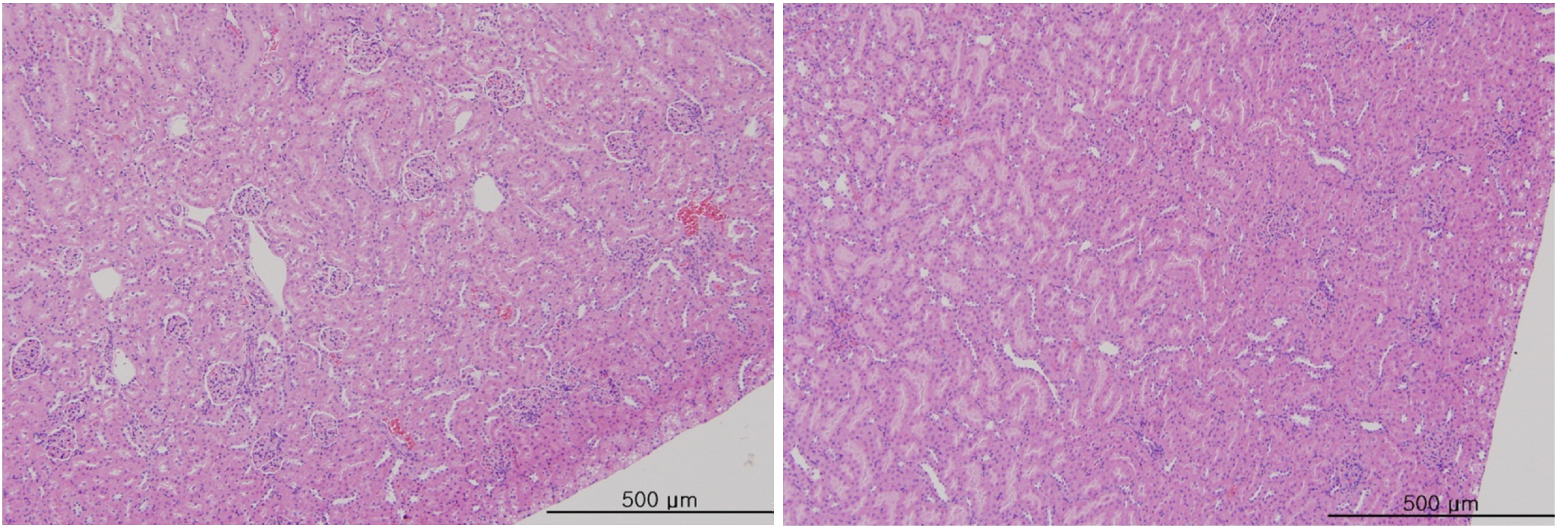 Tissue from a kidney in the intravenous single-dose toxicity study of WSGP in SD rats.