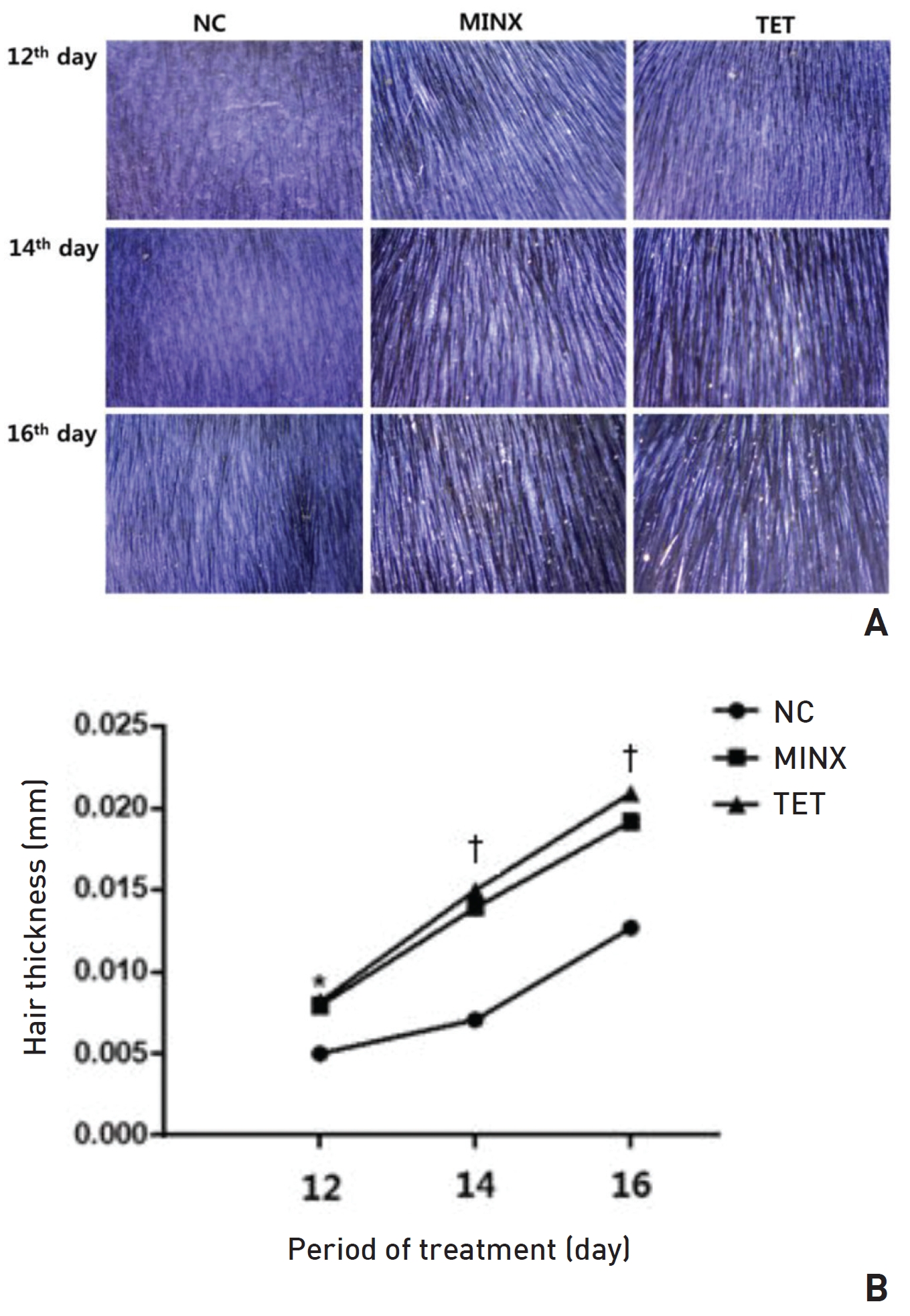 TET also increased the hair thickness of depilated skin lesions on C57BL/6 mice.