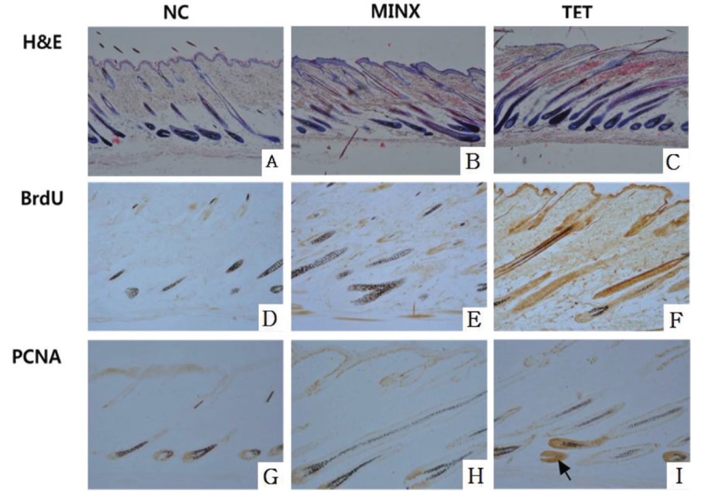 Effects of TET on anagen induction and cellular proliferation in the depilated dorsal skin of C57BL/6 mice.