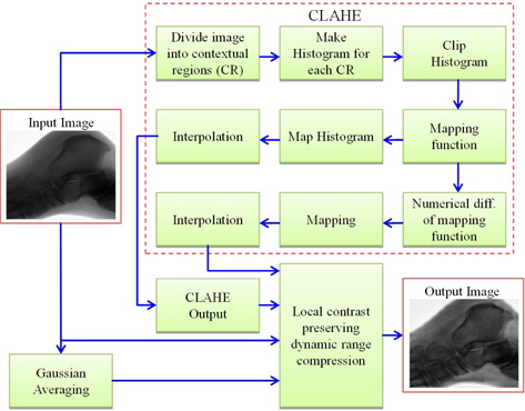 Overall block diagram of proposed image enhancement method. CLAHE, contrast limited adaptive histogram equalization.