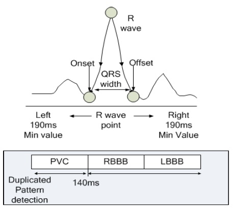 QRS 간격에 따른 중복 패턴 검출