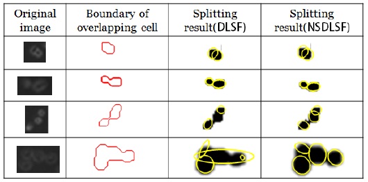 Separation results of overlapping cells (1st column: original images, 2nd column: its boundary, 3rd column: Fitzgibbon’s fitting method, and 4th column: Halir’s fitting method). DLSF: direct least squares fitting, NSDLSF: numerically stable direct least squares fitting.