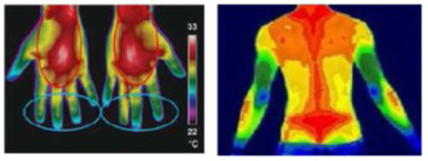 Example digital infrared thermal image.