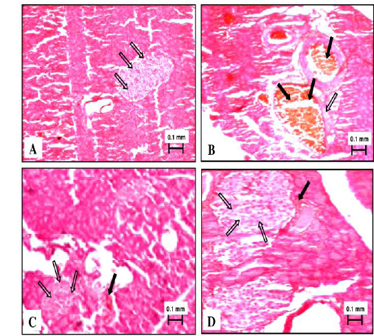 Photomicrographs of Pancreas (Haematoxylin & Eosin staining; X100). (A) Normal control (non-diabetic), (B) Diabetic control, (C) Diabetic + PkE (200 mg/kg), and (D) Diabetic + Glibenclamide. Hollow arrows indicate pancreatic islets; Solid arrows indicate vacuolization of pancreatic islets.