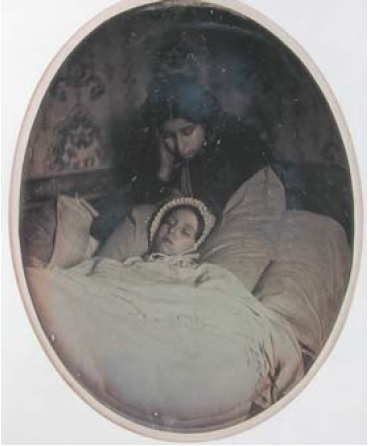 Anonyme, Fillette morte et sa jeune soeur, vers 1850.
