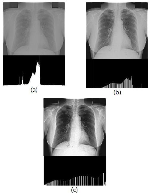 Process of fuzzy logic_histogram equalization. (a) High-frequency emphasis image, (b) fuzzy logic of (a), and (c) histogram equalization of (b).