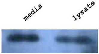 Western blot analysis of rhBMP-2/7 fusion 6× His protein. Sf9 cells were infected with the recombinant baculovirus, harvested at 72 h postinfection, and then examined for rhBMP-2/7 heterodimer protein expression using 6× His monoclonal antibody (see Materials and Methods).