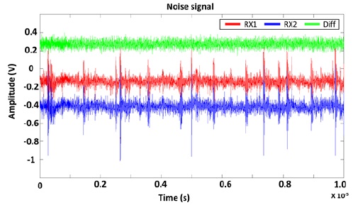 Noise waves measured from real TSP.