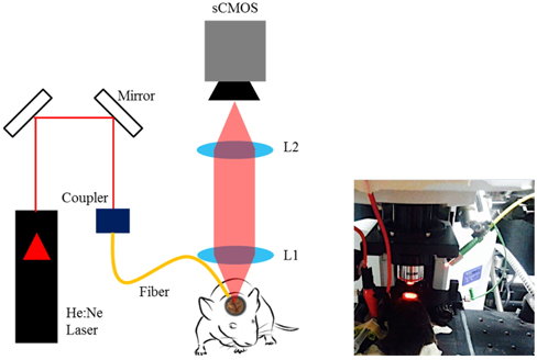 Schematic of laser speckle imaging instrumentation. A He:Ne laser (λ = 632.8 nm) is coupled into a single mode fiber to illuminate the cortex area using a micro-manipulator. The illuminated area is imaged onto a sCMOS camera through the microscope. (L1: objective lens, L2: tube lens, f=180 mm)