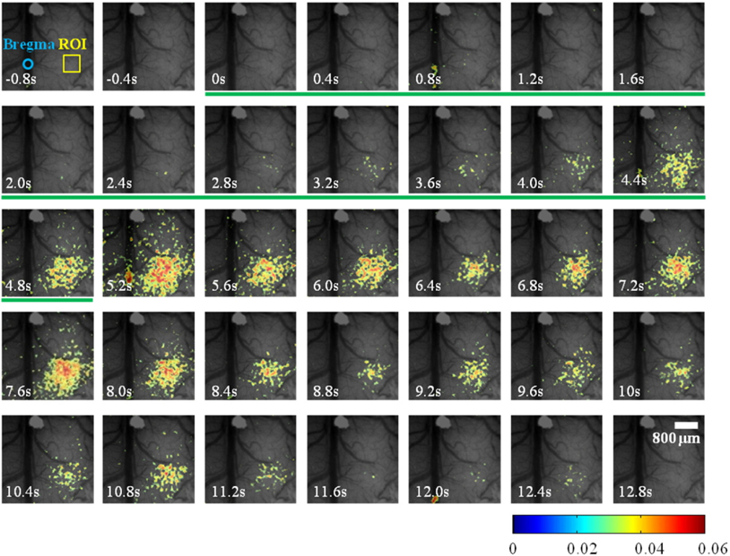Changes in speckle contrast (cerebral blood flow) in response to the electrical sensory stimulation of the hindlimb from 0 to 5 sec based on green bar laser speckle contrast imaging. The speckle contrast images over 3% threshold are overlaid with a white light image at 0.4 sec interval.