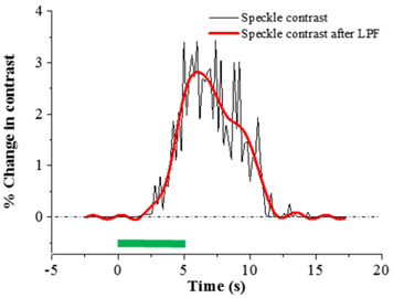 Time courses of percent change in speckle contrast averaged in left hindlimb sensory region (ROI) after low pass filtering (LPF). The stimulation intervals are shown as a green bar.