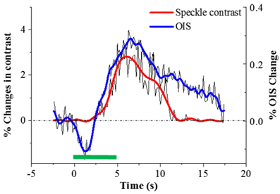 Time courses of percent change in speckle contrast (Red line) and reflectance (Blue line) averaged in left hindlimb (LH) sensory region after low pass filtering. The stimulation intervals are shown as a green bar.