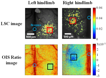 Changes in contrast and OIS ratio images of left and right hindlimb sensory region. Both sides of hindlimb region are symmetrically located in 1.2-1.5 mm apart from the center of the bregma (at 5.2 sec.)