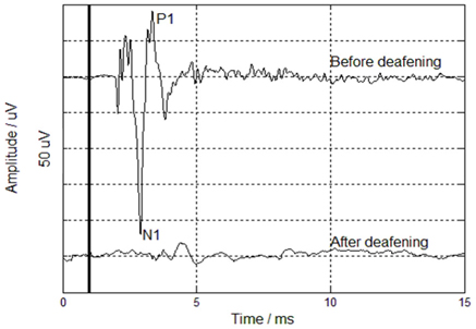 ACAPs measured in intact and deaf animals. The upper curve is ACAP measured in an intact animal, while the bottom curve is ACAP measured in a deaf animal. The heavy vertical line at 1 ms represents the time of stimulation. Each grid represents 50 μV.