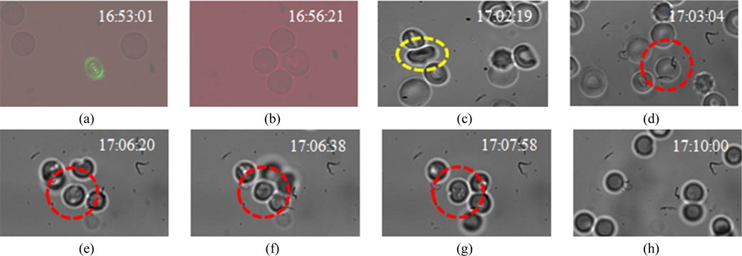 Bright-field images of trapping events: (a) slightly defocused spot of trapping beam created by 60X MO (captured by Lumenera camera), (b) a quad of trapped RBCs (see multimedia S1), (c) reshaping of one of the RBC along K-vector when the very same trapping beam of arbitrary beam profile was focused by 100X lens, (d) - (g) time sequence snapshots of trapping of RBC by 60X lens. Snapshots (a-b) are extracted from multimedia captured by Lumenera camera whereas (c-h) are still-snapshots captured by another CCD camera (SANSOVATION-SamBa EZ-130).