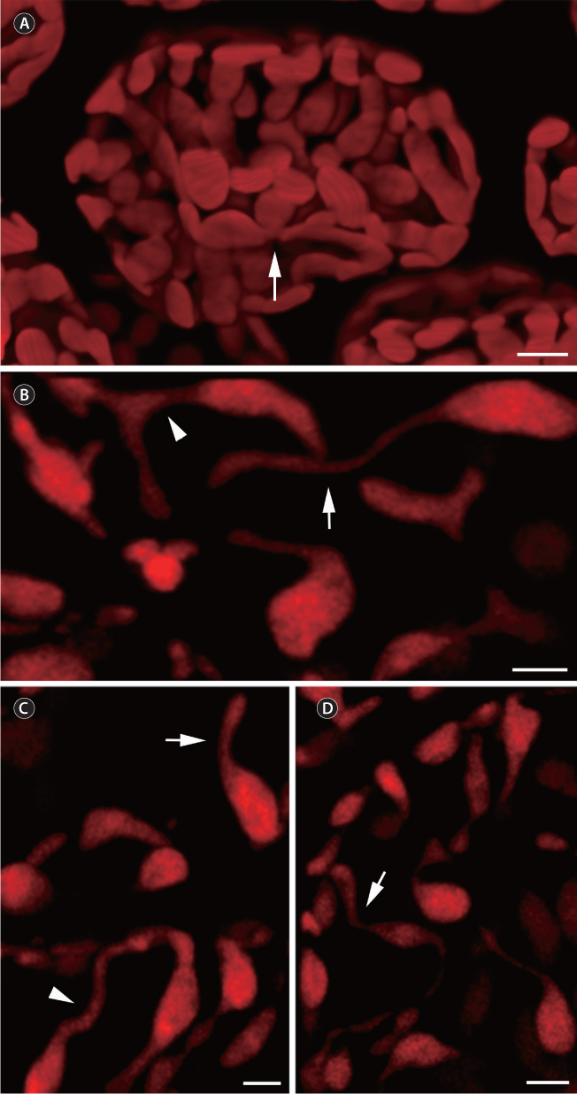 Choroplast lobes (CLs) in Laurencia. (A) A three-dimensional reconstruction with confocal laser scanning microscopy (LSM) images of fusionned chloroplasts (arrow) in Yuzurua poiteaui var. cortical cells. (B) LSM images of thin undulated (arrow) and thick linear (arrowhead) CL in L. dendroidea cortical cells. (C & D) Short / unilateral (arrows) and thick / bilateral (arrowheads) CL in L. dendroidea cortical cells. Scale bars represent: A-D, 2 μm.