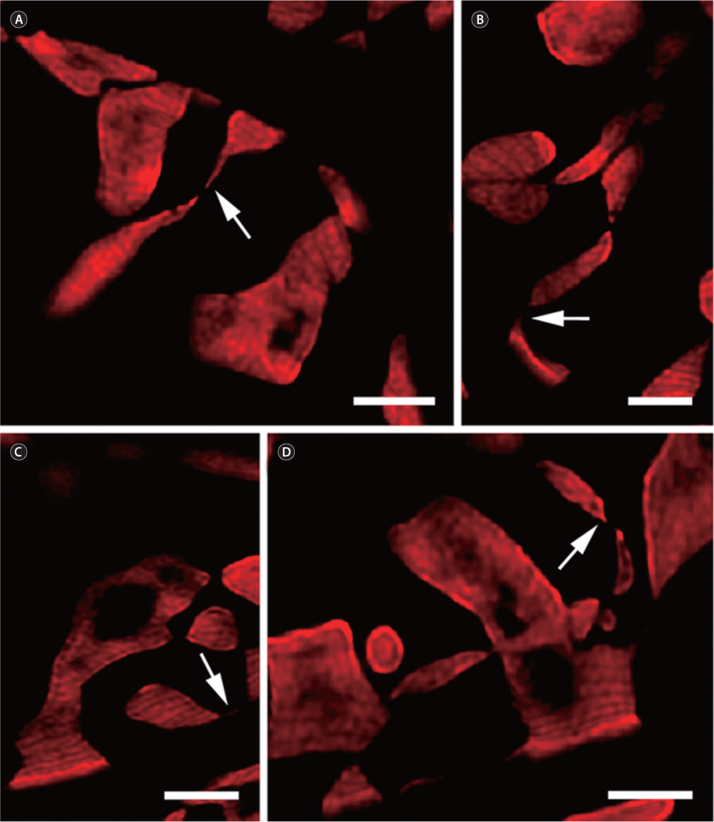 Choroplast lobes (CLs) in Laurencia translucida cortical cells. (A & B) Confocal laser scanning microscopy images of thin / unilateral CLs (arrows). (C & D) CLs always as inconspicuous projections (arrows). Scale bars represent: A-D, 2 μm.