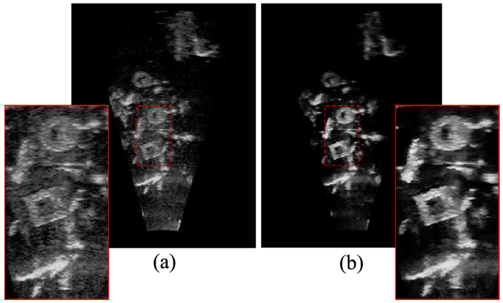 Sonar image enhacement with CLAHE, gamma correction and bilateral filter (a) original (b) enhanced image