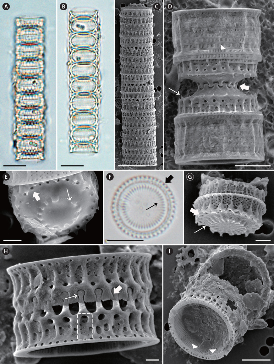 Micrographs of Paralia guyana taken using light microscopy (A, B & E) and scanning electron microscopy (C, D & F-I). (A-C) Girdle view of eight-celled chain. Upper (A) and middle (B) focus girdle view of the specimen. (D) Girdle view of interlocked, sibling, separation valves with internal linking spines (thick arrow); slits in copulae (arrowhead) and well-developed prickles (thin arrow). (E) Valve view of separation valve. Internal linking spines (thin arrow), marginal pore (thick arrow). (F) Valve view of intercalary valve. Internal linking spines (thin arrow), marginal pore (thick arrow). (G) Valve view of intercalary valve with interlocking radiating processes and fenestrae. Internal linking spines (thin arrow), marginal pore (thick arrow). (H) Girdle view of interlocked, sibling, intercalary valves. Extended marginal linking spines (thin arrow) in relief valve; short, blunt marginal linking spines (thick arrow) in intaglio valve; visible fenestra (dashed square). (I) Internal valve view with internal striae and rimoportulae. Rimoportula (arrowheads). Scale bars represent: A-C & E, 10 μm; D & H, 5 μm; F & G, 2 μm; I, 1 μm.