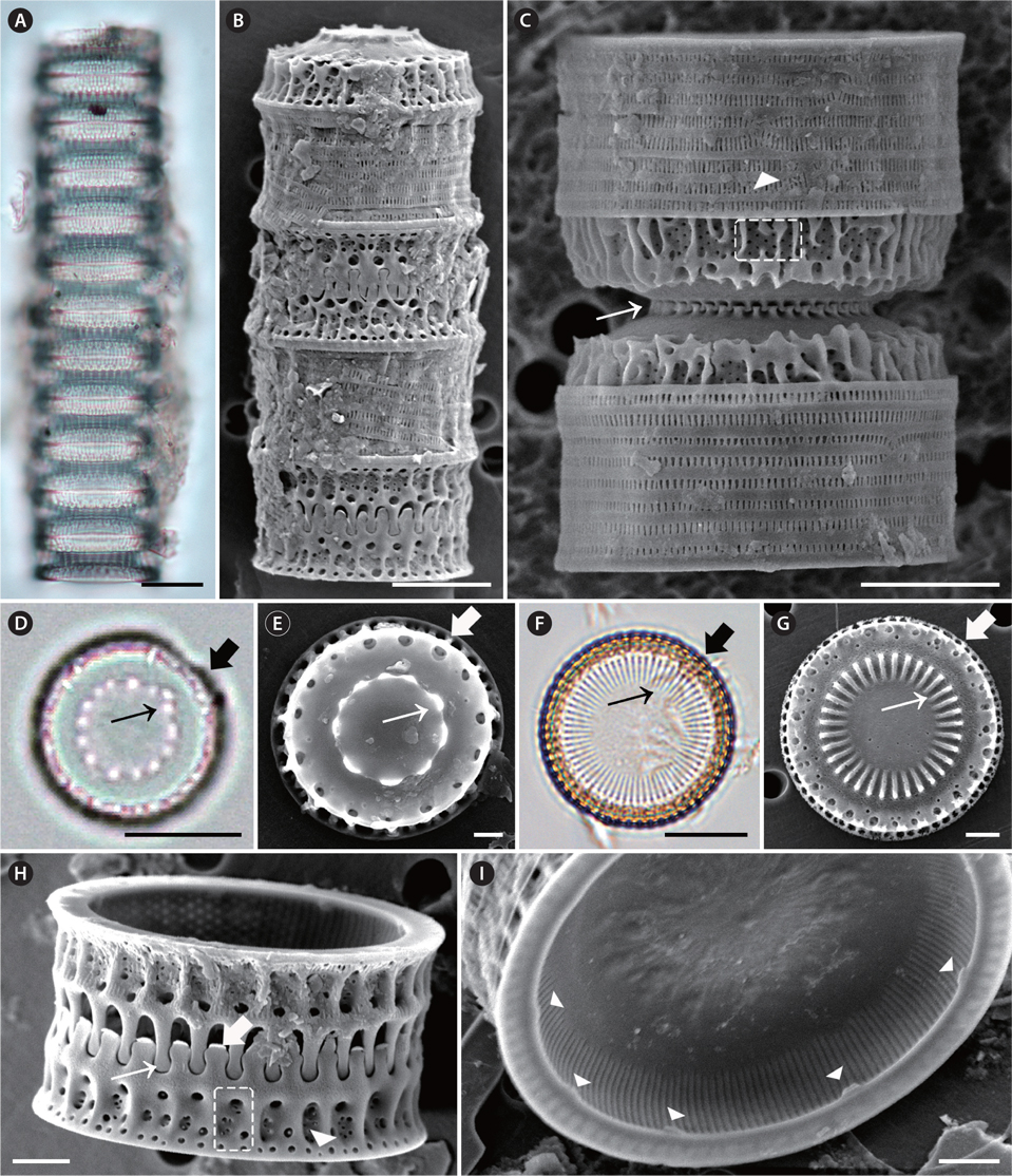 Micrographs of Paralia marina taken using light microscopy (A, D & F) and scanning electron microscopy (B, C, E & G-I). (A & B) Girdle view of chained cells. Upper (A) focus girdle view of 11-celled chain. (C) Girdle view of interlocked, sibling, separation valves. Slits in copulae (arrowhead) and internal linking spines (thin arrow), decussated pattern of poroid areolae (dashed square). (D) Valve view of separation valve. Internal linking spines (thin arrow); marginal pore (thick arrow). (E) Valve view of separation valve. Internal linking spines (thin arrow), marginal pore (thick arrow). (F) Valve view of intercalary valve. Internal linking spines (thin arrow), marginal pore (thick arrow). (G) Valve view of intercalary valve with interlocking radiating processes. Internal linking spines (thin arrow); medium-sized marginal pore (thick arrow). (H) Sibling valves held together by long and capitate-shaped marginal linking spines. There are two rings of pores and fenestrae parallel to the mantle edge. Marginal linking spines (thin arrow) in relief valve; marginal linking spines (thick arrow) in intaglio valve; rimoportula (arrowhead); external pore of the rimoportula (dashed square). (I) Internal valve view with internal striae and rimoportulae. Rimoportula (arrowheads). Scale bars represent: A & F, 10 μm; B-D, 5 μm; E, 1 μm; G-I, 2 μm.
